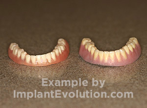 procedure before image Dentures procedure before image Dentures