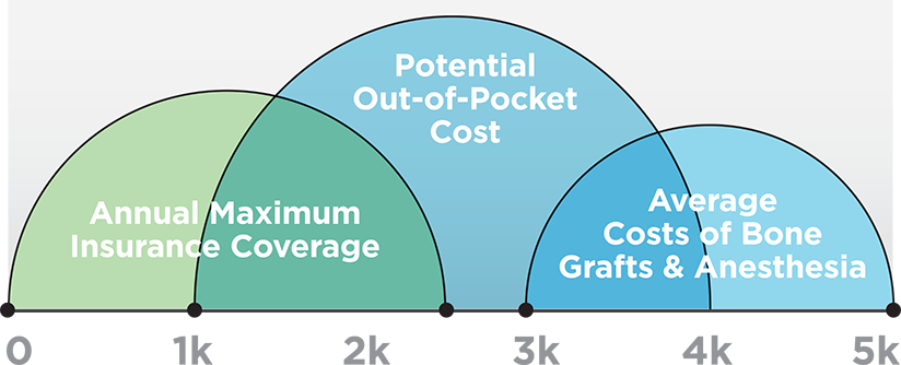 Bottom Line Dental Implant Costs