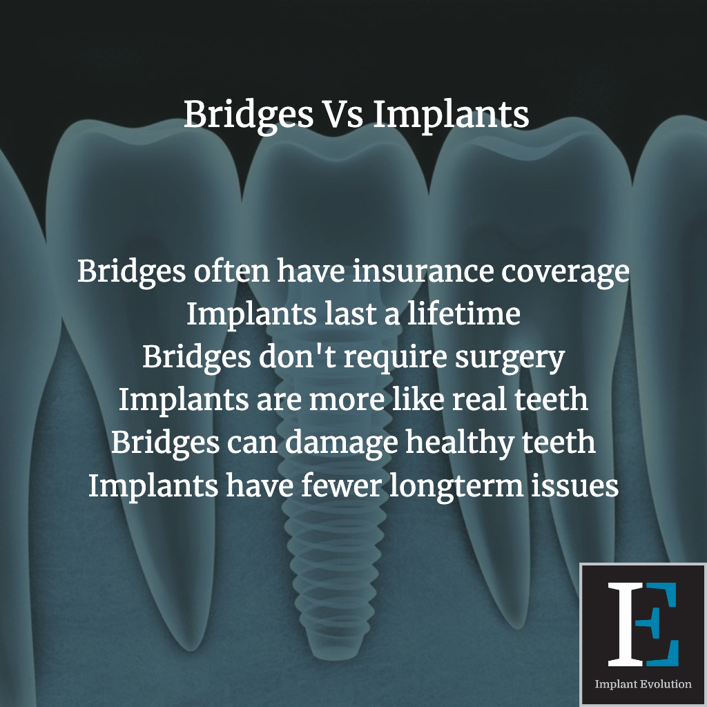 Bridges vs implants