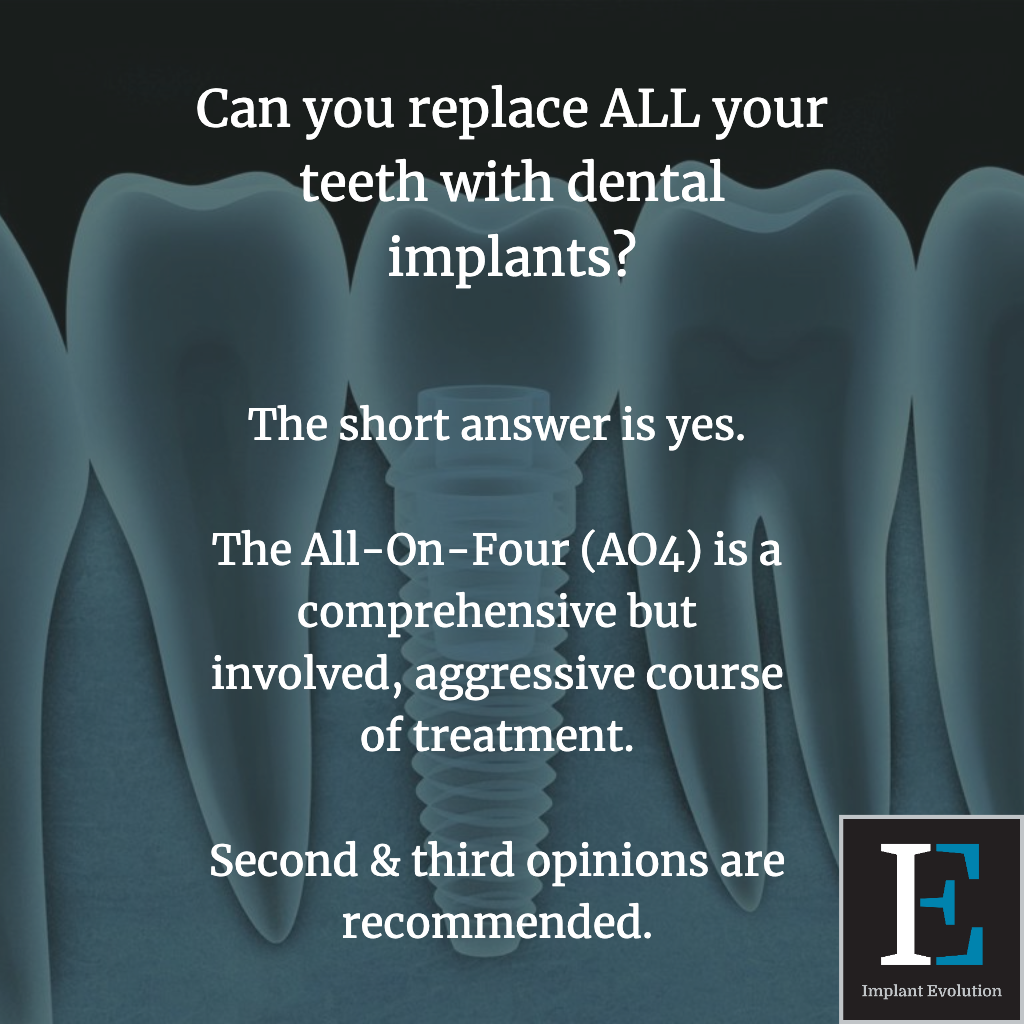 Can you replace all your teeth with dental implants? Implant Evolution