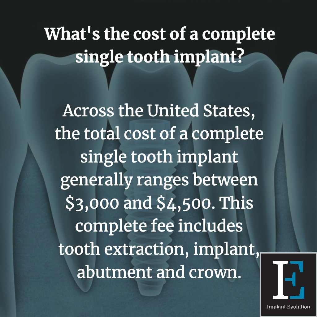 Cost Of A Complete Single Tooth Implant 1024x1024 