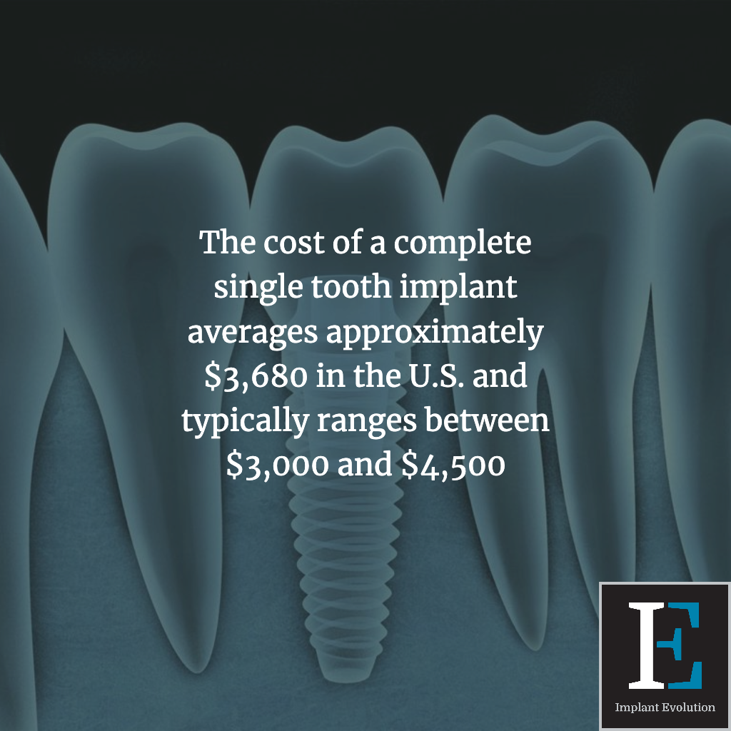 The cost of a complete single tooth implant averages to $3,680.