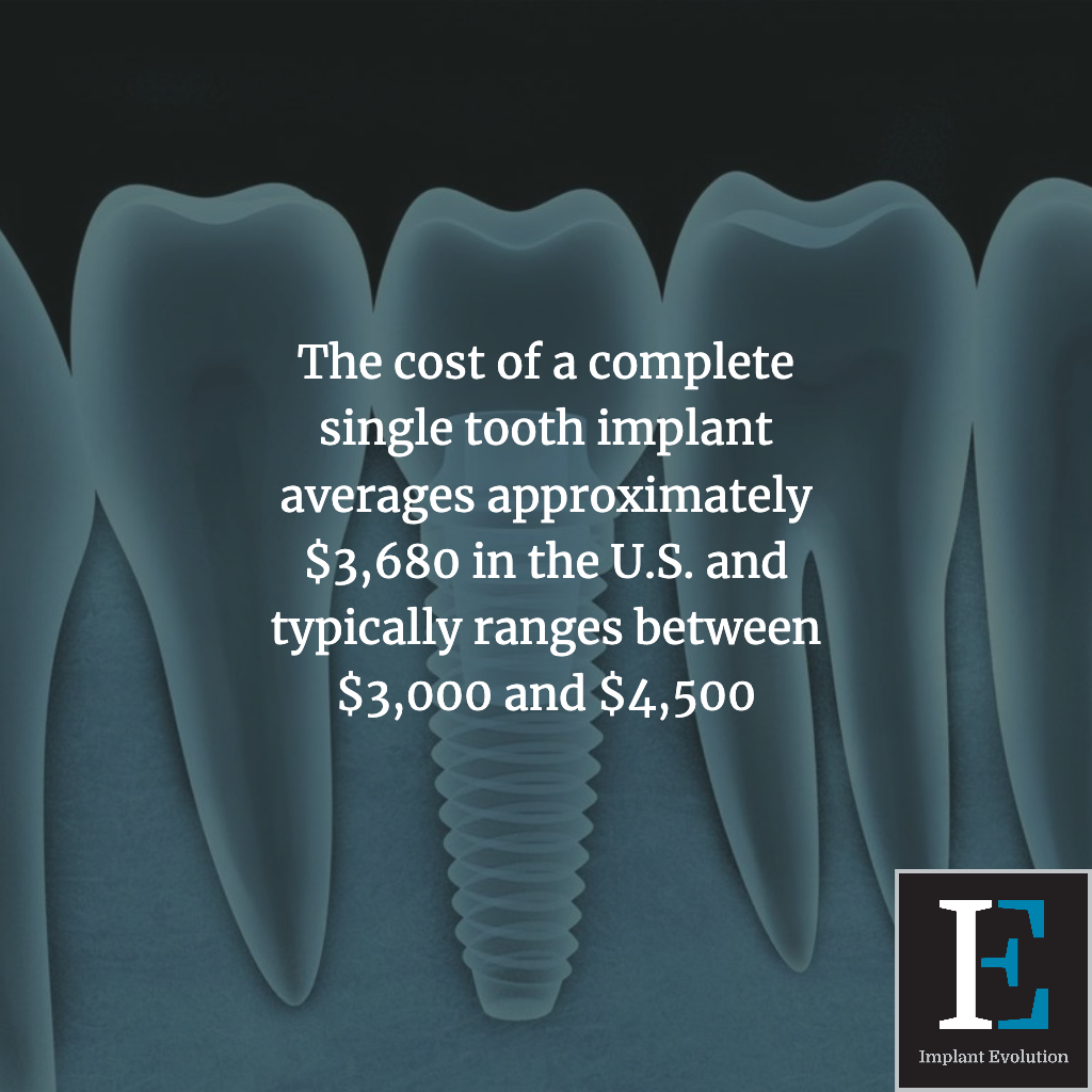 Are there cheap dental implants? Implant Evolution