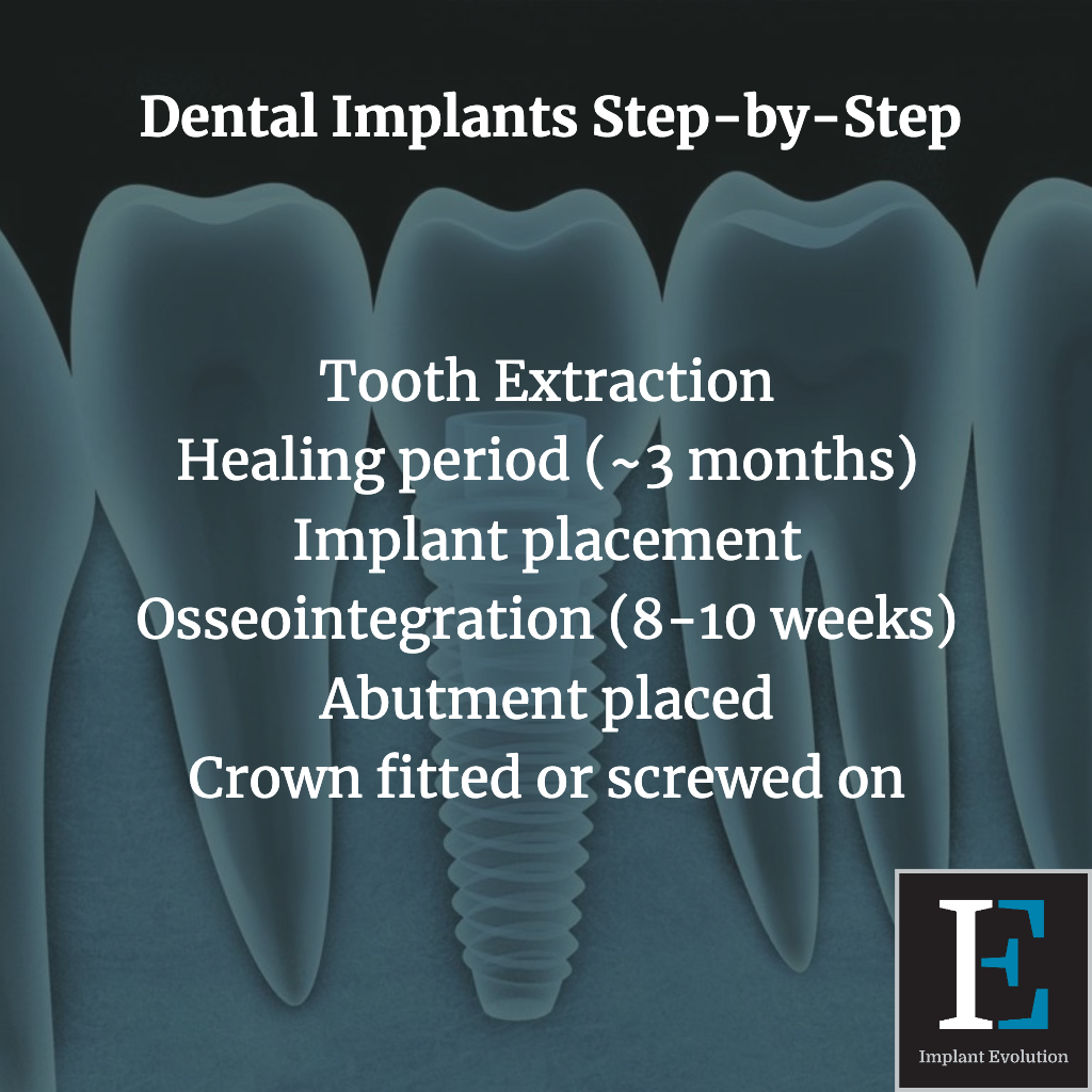 Dental implant step by step