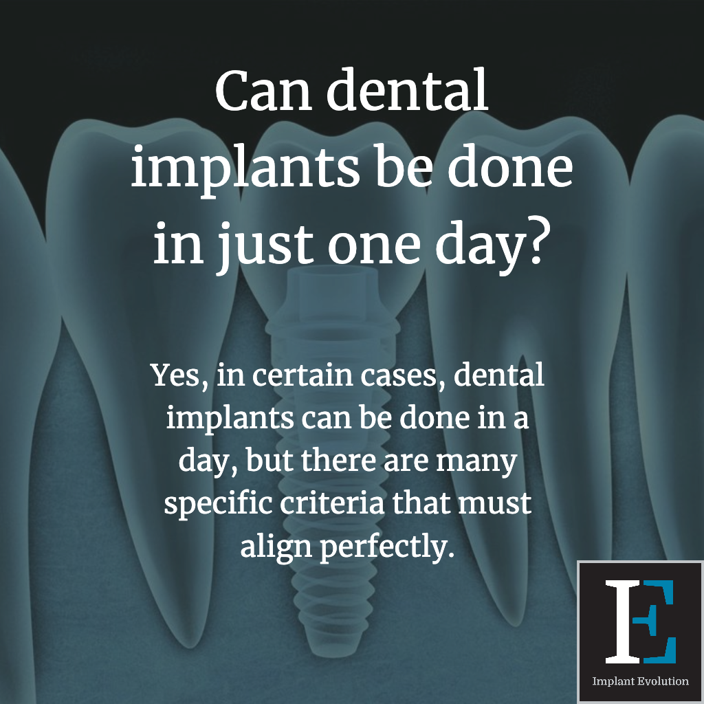 Can dental implants be done in one day? Yes, if you meet the specific criteria.