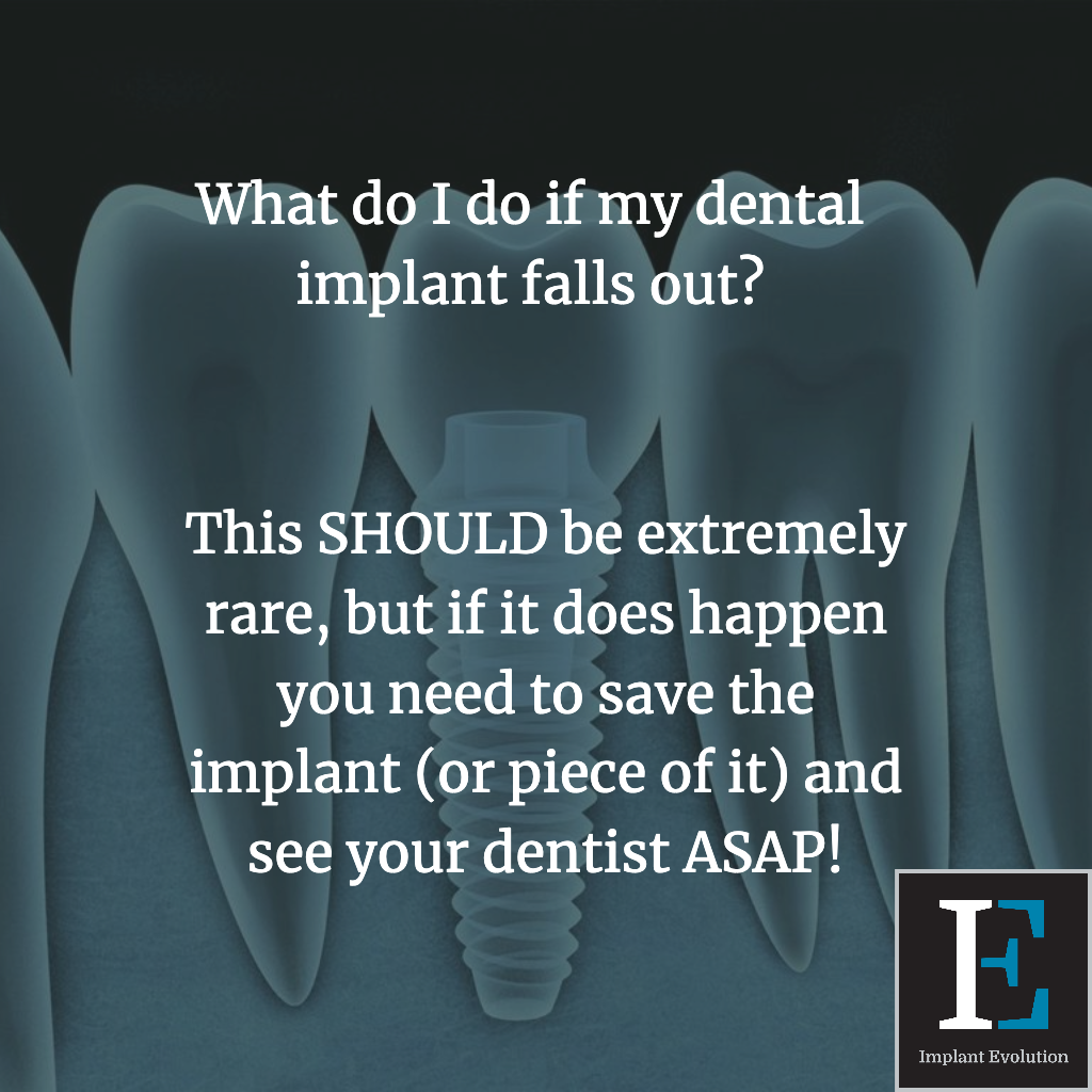 What do I do if my dental implant falls out? Implant Evolution